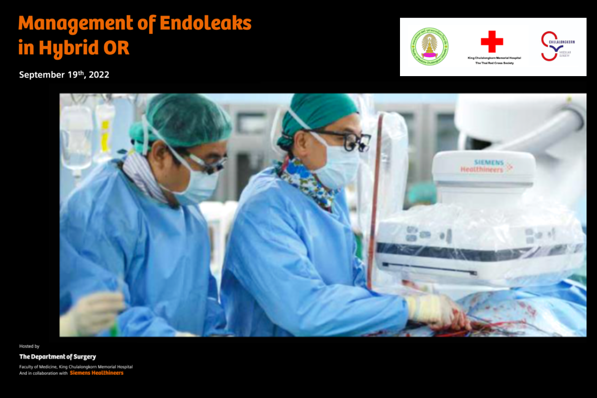 Management of Endoleaks in Hybrid OR