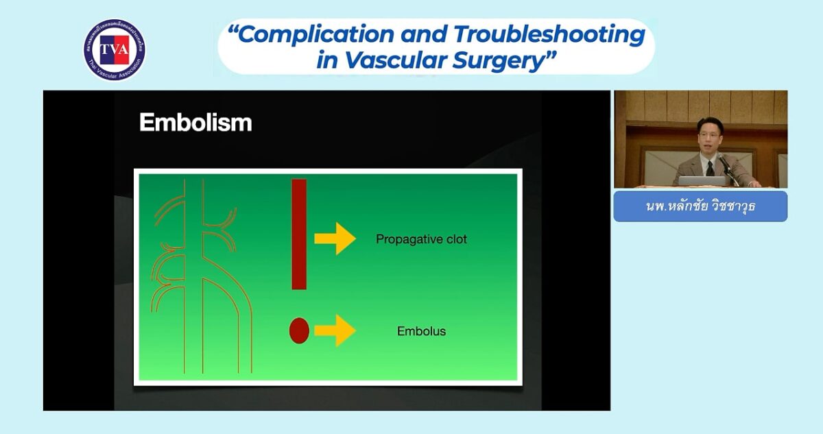 Arterial complications during embolectomy: cause and treatment