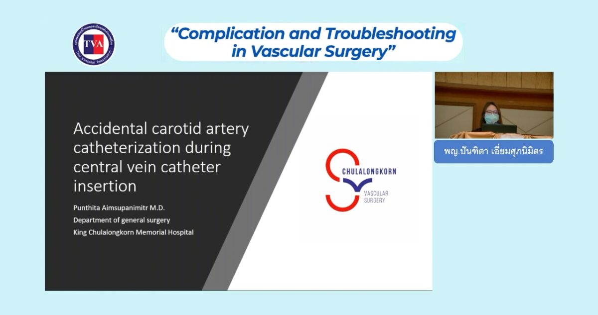 Accidental carotid artery catheterization during central venous catheter insertion: prevention and management