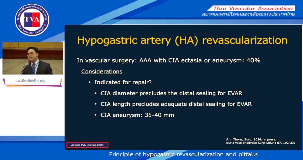 0503 – Principle of hypogastric revascularization and pitfalls