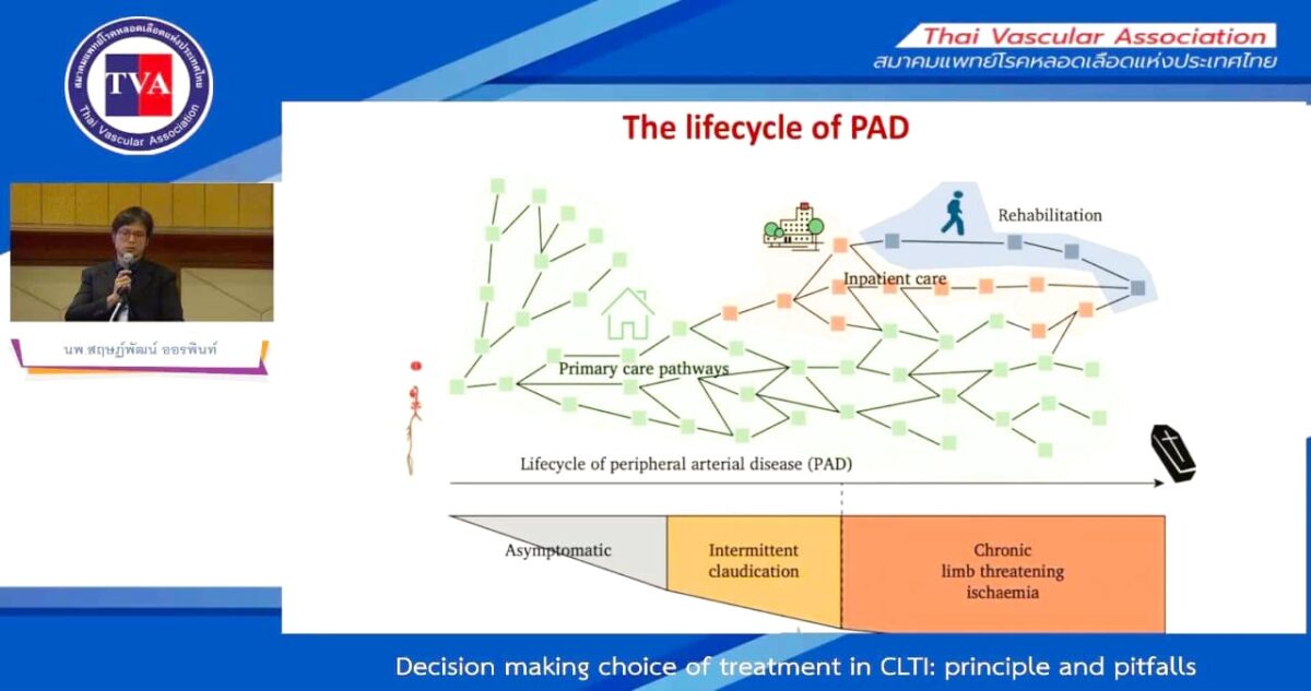 0602 – Decision making of treatment in CLTI: principle and pitfalls