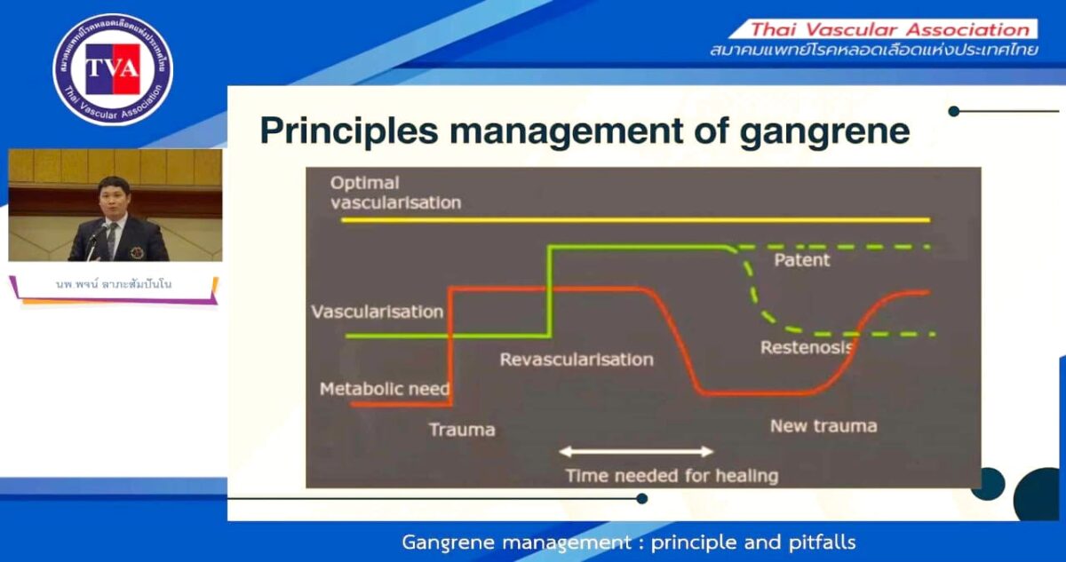 0603 – Gangrene management: principle and pitfalls