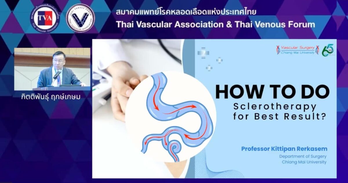 0906 – How to do sclerotherapy for the best results?