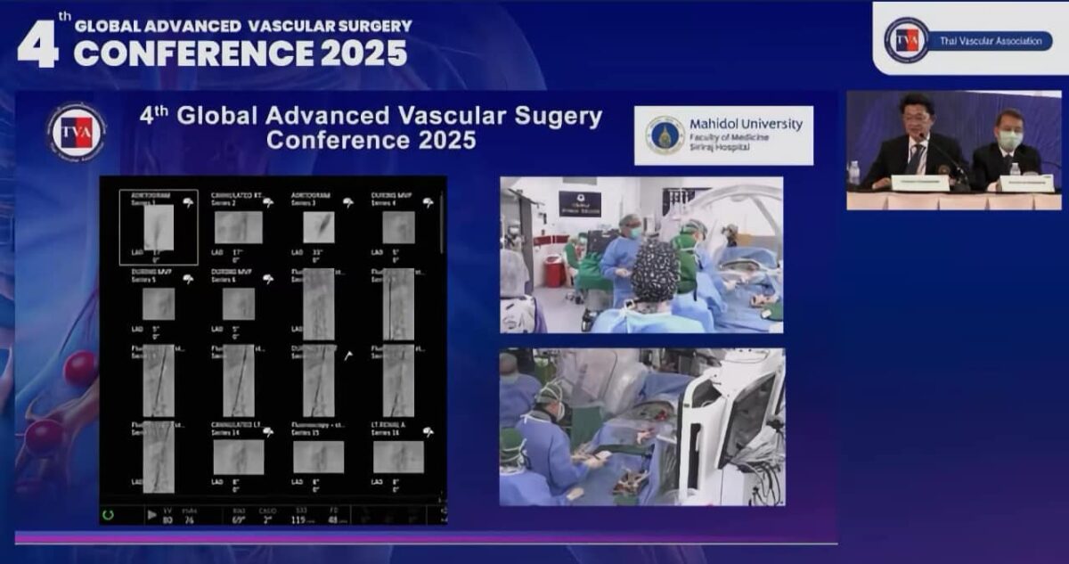 090108 – Live Case Transmission 2 Siriraj Hospital